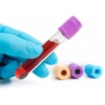 ЭПР ТСА тест отзывы