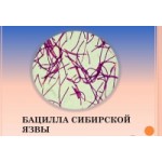 Сибирская язва отзывы