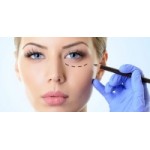 Блефаропластика отзывы